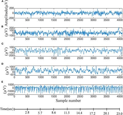 Modified-Distribution Entropy as the Features for the Detection of Epileptic Seizures